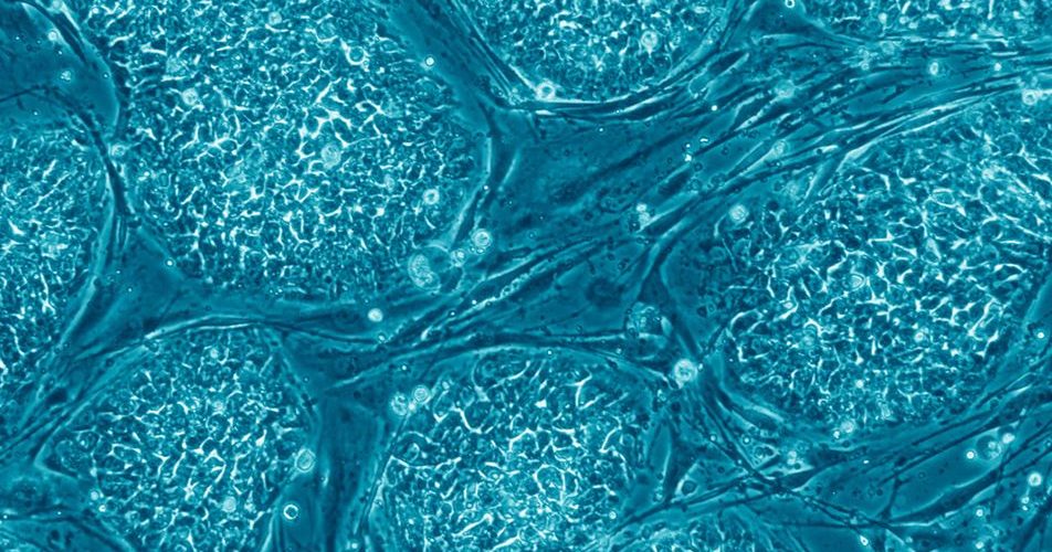 Menage a un - Human Embryonic Stem Cells